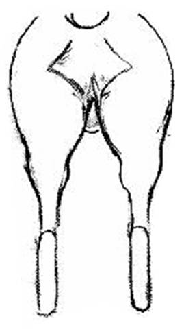 Fig.2